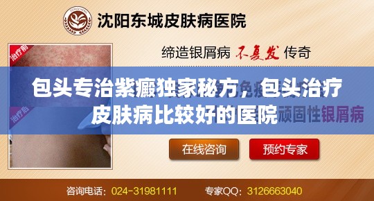 包头专治紫癜独家秘方，包头治疗皮肤病比较好的医院 