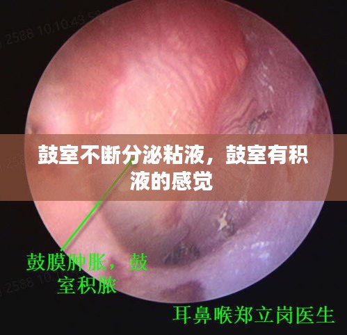 鼓室不断分泌粘液，鼓室有积液的感觉 