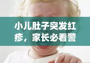 小儿肚子突发红疹，家长必看警惕！