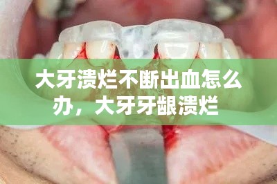 大牙溃烂不断出血怎么办，大牙牙龈溃烂 