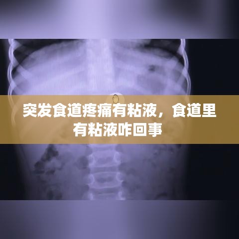 突发食道疼痛有粘液，食道里有粘液咋回事 
