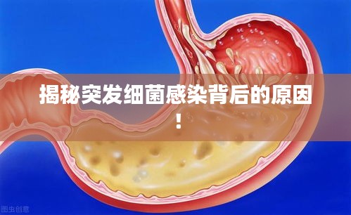 揭秘突发细菌感染背后的原因！