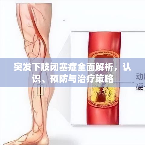 突发下肢闭塞症全面解析，认识、预防与治疗策略