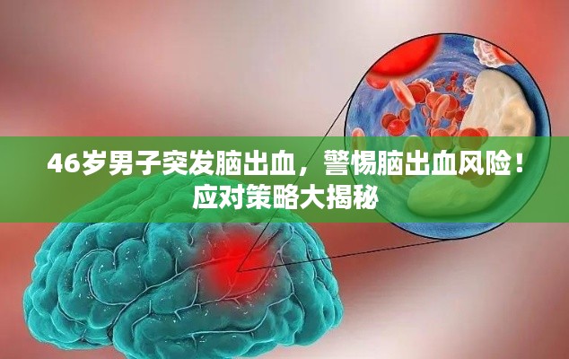 46岁男子突发脑出血，警惕脑出血风险！应对策略大揭秘